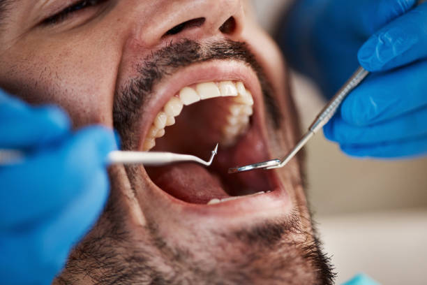 Best Urgent Dental Care for Toothache in Montague, CA
